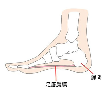 足底筋膜画像